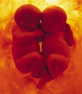 ABORCJA-WSPÓŁCZESNA RZEŻ NIEWINIĄTEK - c691f02ebd.jpg